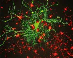 Großes Neuron im Gehirn der Ratte, Foto: EnCor Biotechnology Inc. / GerryShaw (via Wikimedia / CC BY-SA 3.0)